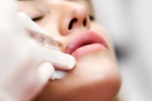 Lip Filler